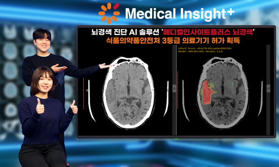 SK C&C가 개발한 뇌경색 진단 AI솔루션 '메디컬인사이트플러스 뇌경색'이 식품의약품안전처로부터 3등급 의료기기 허가를 받았다.
