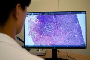 루닛, AI 통한 개인 맞춤형 항암치료 가능성 선보여