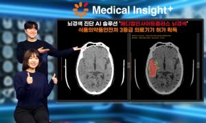 SK C&C ‘뇌경색 진단 AI 솔루션’, 식약처 의료기기 품목 허가받아